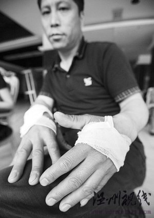 新郎与喜宴音响师冲突面部可能失去知觉