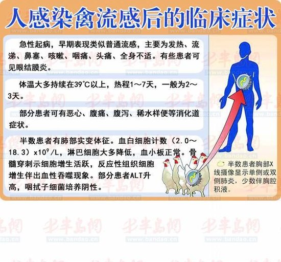 h7n9诊疗方案