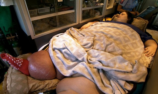 美国最胖女子梅拉体重544公斤