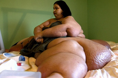 美国最胖女子梅拉体重5
