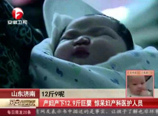 山东产妇产下12.9斤巨婴