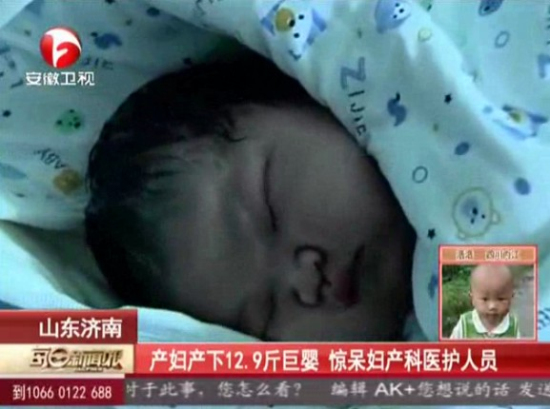 山东产妇产下12.9斤巨婴