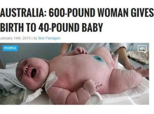 澳大利亚女子诞下18公斤巨婴