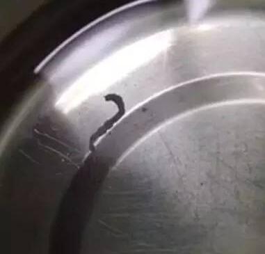 宁波女子喝蛇血体内长了一条3厘米的寄生虫