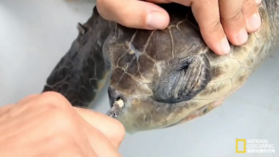 海龟鼻中拔出吸管