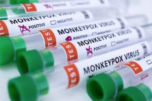 智利报告首例猴痘病