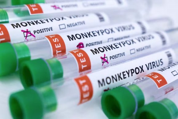 智利报告首例猴痘病例