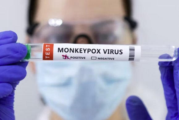 美国可能需要近70亿美元来抗击猴痘疫情
